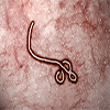 Obama Says Ebola is a National Security Threat