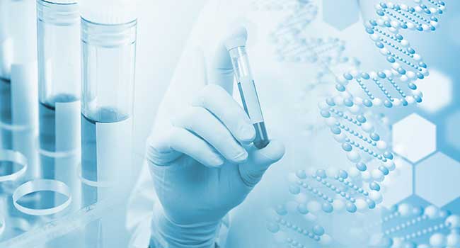 At-Home DNA Test Kits Raise Security Questions