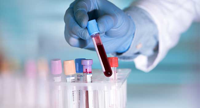 LabCorp Data Breach Put Millions at Risk