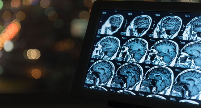 Millions of Americans’ Medical Images Were Left Unprotected on The Web, Report Finds